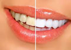 Міфи про зуби